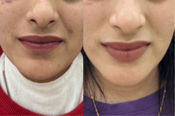 Untitled design (51)